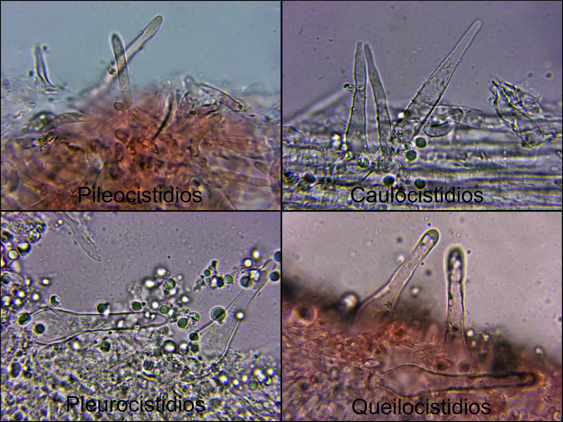 Microscopía de 10 - Mycenella salicina cistidios